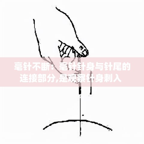 毫针不断：毫针针身与针尾的连接部分,是观察针身刺入 
