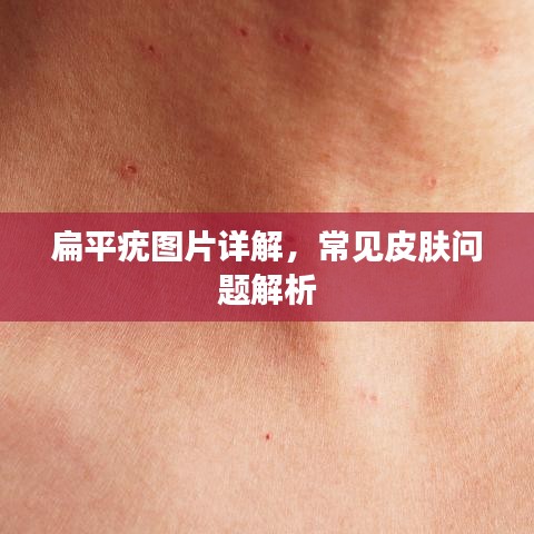 扁平疣图片详解，常见皮肤问题解析