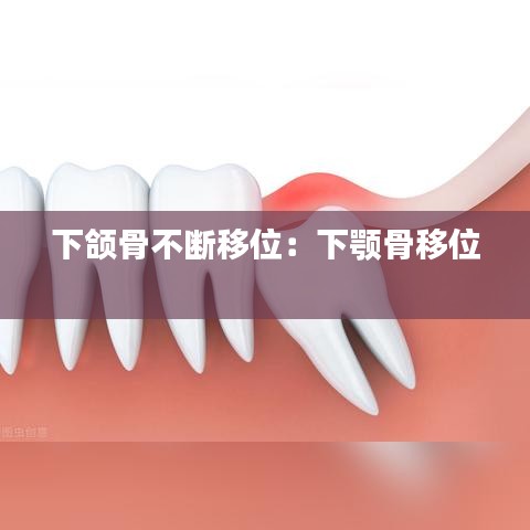 下颌骨不断移位：下颚骨移位 
