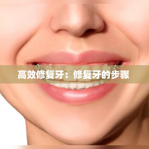 高效修复牙：修复牙的步骤 