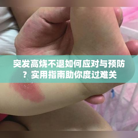 突发高烧不退如何应对与预防？实用指南助你度过难关