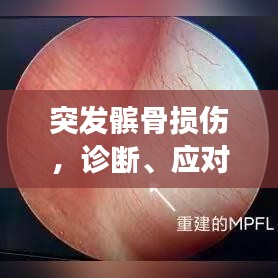 突发髌骨损伤，诊断、应对与康复全攻略