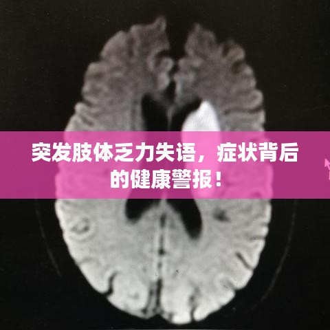 突发肢体乏力失语，症状背后的健康警报！