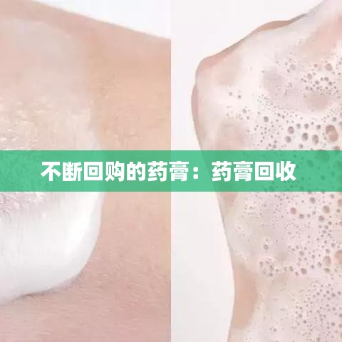 不断回购的药膏：药膏回收 