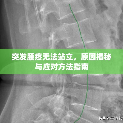 突发腰疼无法站立，原因揭秘与应对方法指南