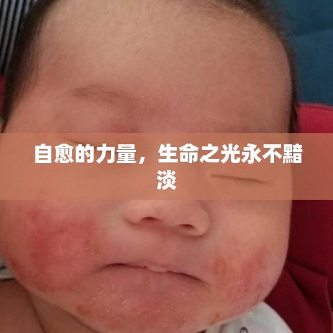 自愈的力量，生命之光永不黯淡