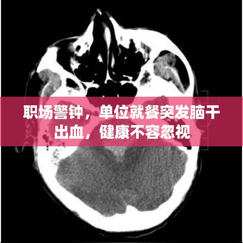 职场警钟，单位就餐突发脑干出血，健康不容忽视